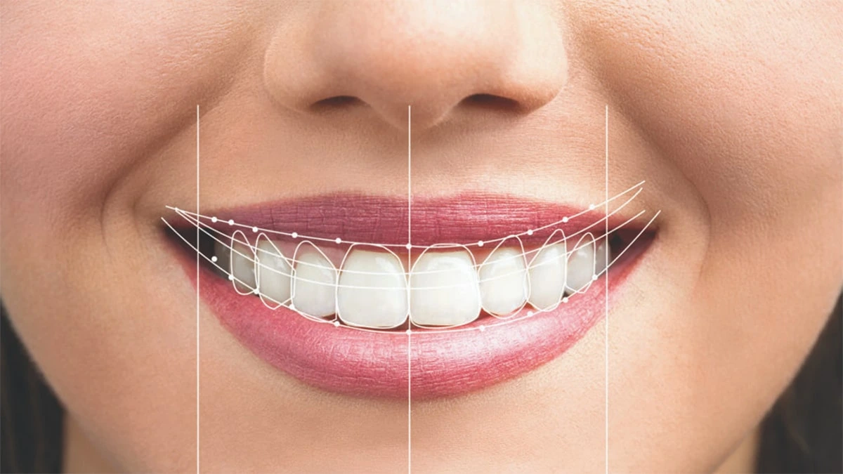 تولید سرامیکهای دندانی بادوام و طبیعی