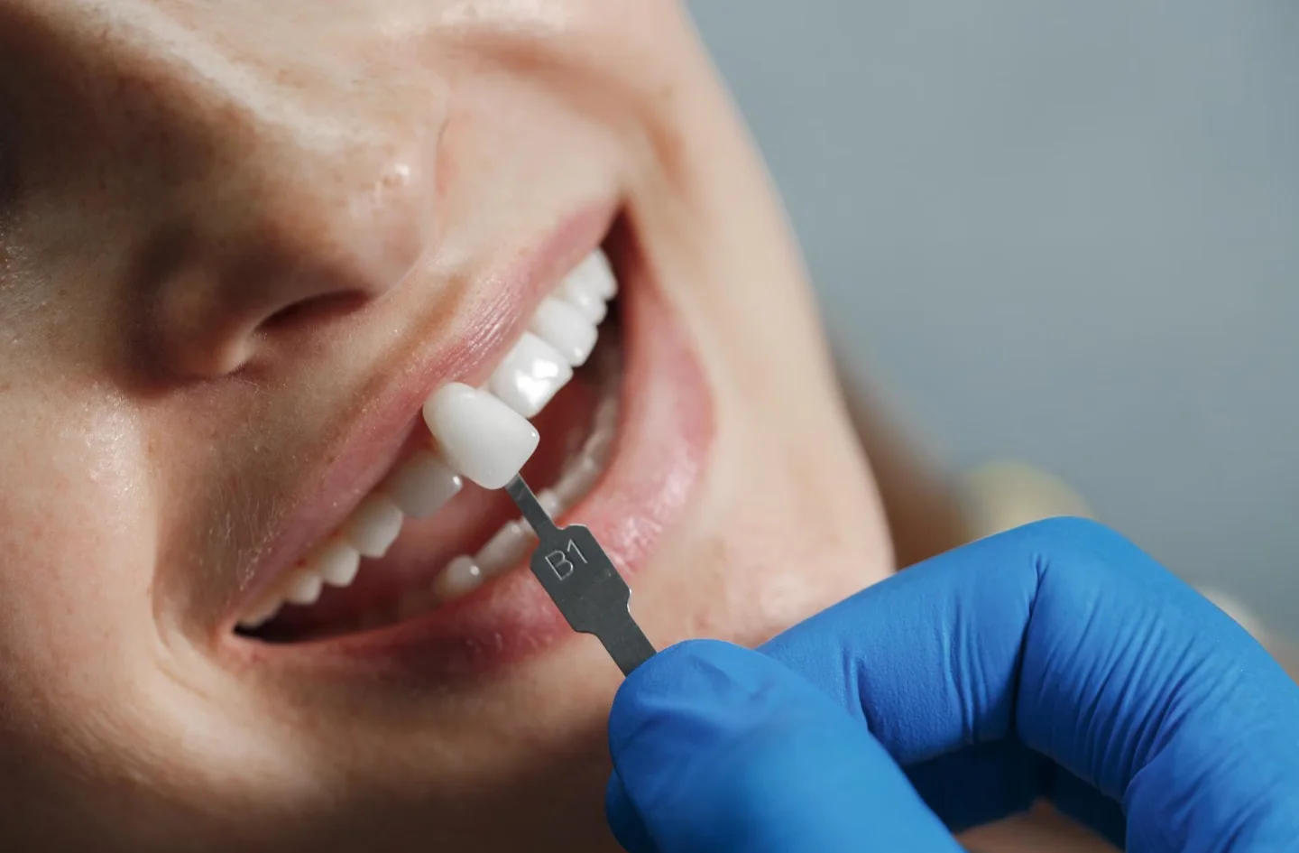 بررسی خواص مکانیکی و بیولوژیکی مواد کامپوزیتی دندانی جدید