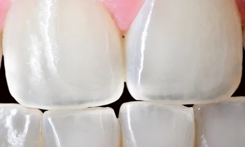 بهترین انتخاب برای دندان‌پزشکان حرفه‌ای