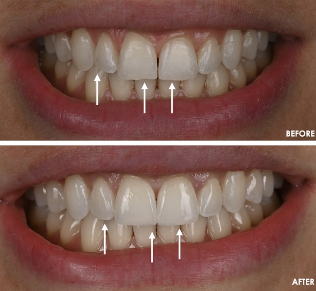 اسید اچ و زیبایی ترمیم